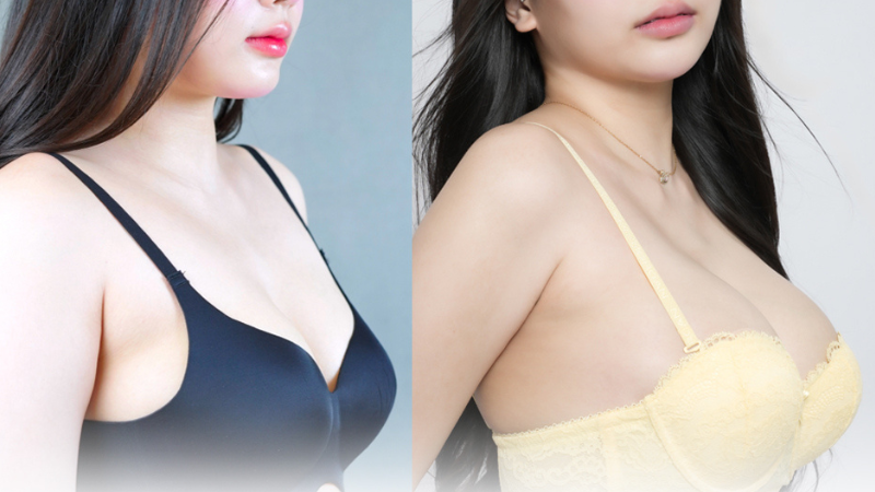 Thiet ke chua co ten 22