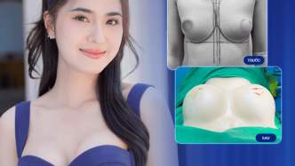 Thiet ke chua co ten 4 min