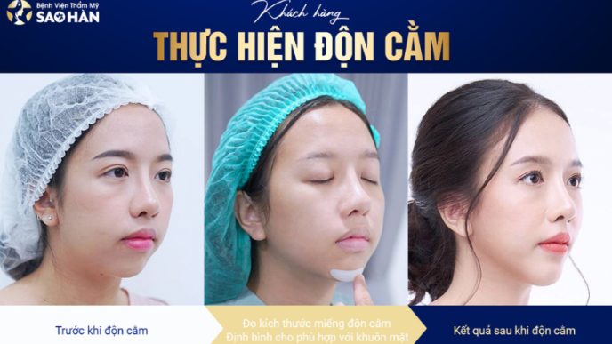 dich vu don cam v line tai benh vien sao han