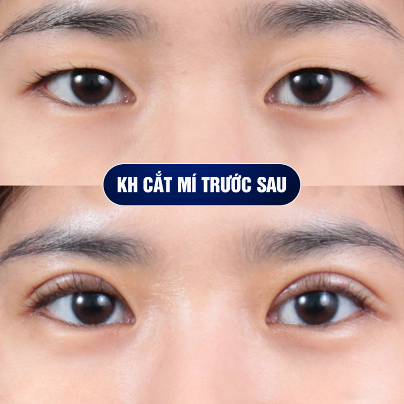 khách hàng được cam kết về kết quả làm đẹp