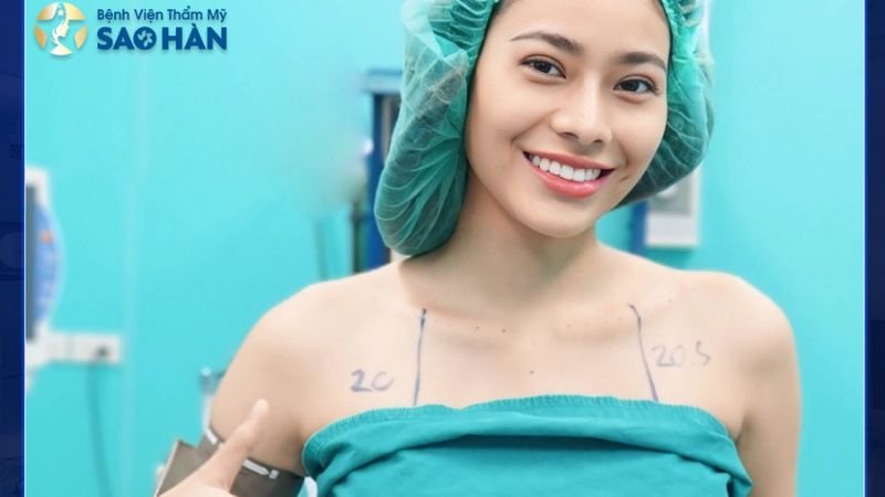 phẫu thuật môi cười tại bệnh viện Sao Hàn
