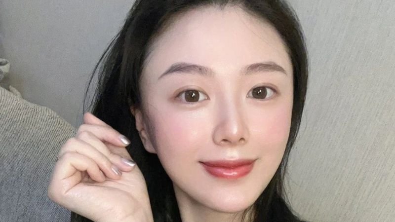 phẫu thuật môi cười tại bệnh viện Sao Hàn