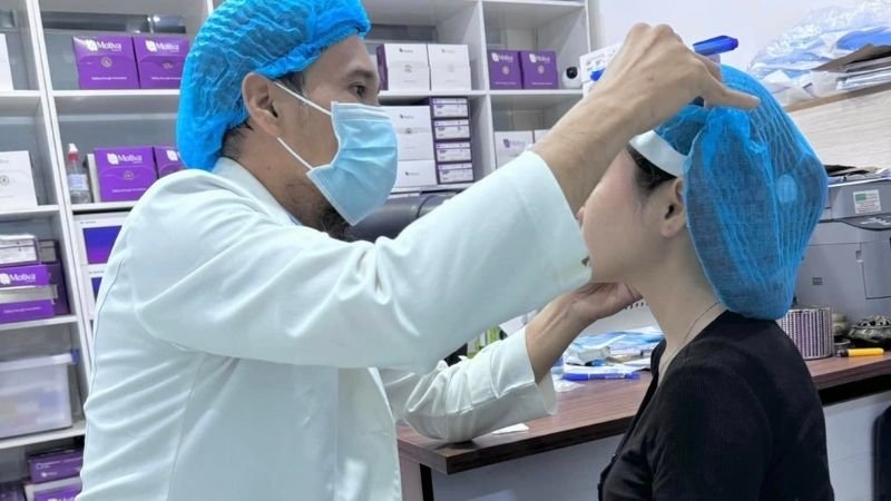 Nâng mũi sau 1 tháng bị sưng